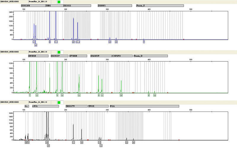 Genotype of cadaver bones buried for 3 months obtained using the PowerPlex 16 HS System.